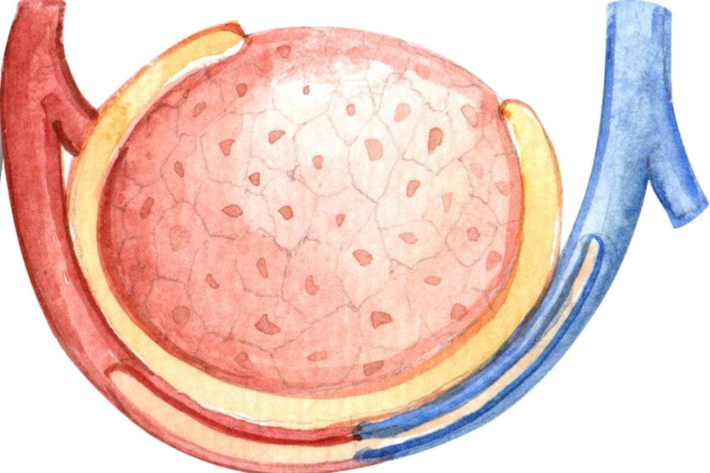 Hidrocele y quistes testiculares